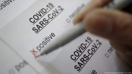 Latinoamérica debe acelerar vacunas y test para lograr inmunidad contra el COVID-19