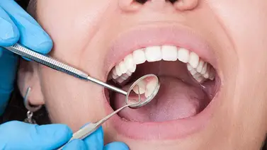 Enfermedades que se pueden detectar por la boca Enfermedades que se pueden detectar por la boca