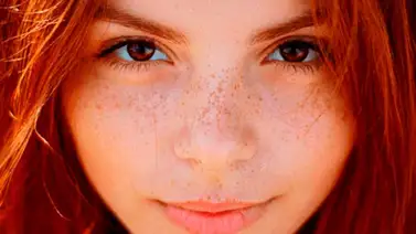 Así debes cuidar la piel con pecas Así debes cuidar la piel con pecas