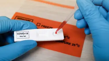 Advierten de hasta 30 % de falsos negativos de COVID-19 en prueba de antígenos Advierten de hasta 30 % de falsos negativos de COVID-19 en prueba de antígenos