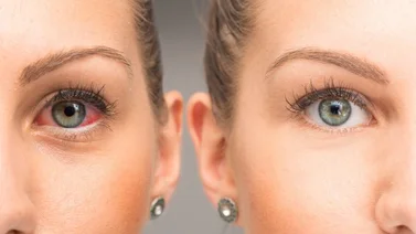 Ojos rojos: causas y soluciones