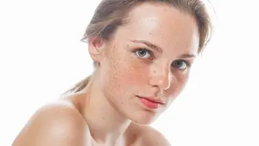 Aprende cómo disimular las pecas de manera natural Aprende cómo disimular las pecas de manera natural