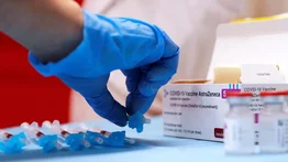 Estudian trombosis cerebral en mujer vacunada con AstraZeneca