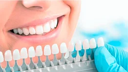 Elimina el amarillo de tus dientes con estos trucos