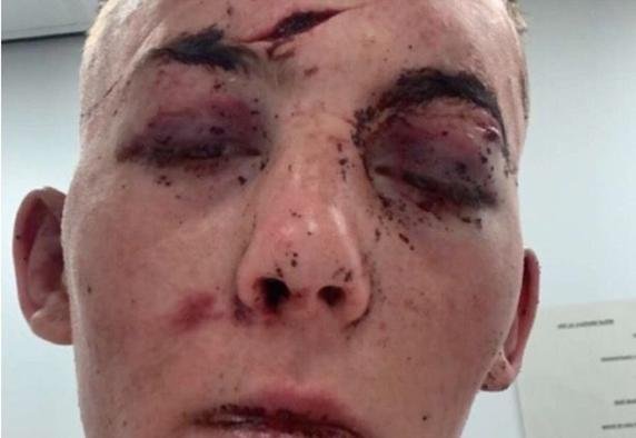 Joven escocés es secuestrado y torturado en una cita Tinder (+Fotos) Joven escocés es secuestrado y torturado en una cita Tinder (+Fotos)