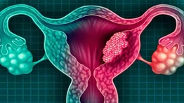 Día Mundial de Prevención del Cáncer de Cuello Uterino