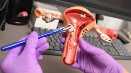 Mortalidad por cáncer de cuello uterino ocupa segundo lugar en Venezuela