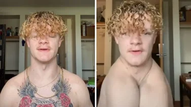 Un chico nació sin clavículas, fue discriminado y ahora busca hacerse famoso