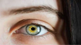 Joven de la India sangra por los ojos durante ciclo menstrual