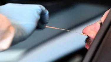 Pérdida de olfato podría anticipar un buen pronóstico para pacientes con la COVID-19