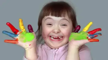 Hoy se celebra el Día Mundial de los Defectos del Nacimiento Hoy se celebra el Día Mundial de los Defectos del Nacimiento