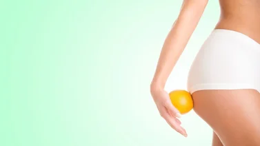 Eliminar la celulitis no es imposible, te decimos ¿cómo?