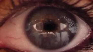 Científicos resucitarán ojos de fallecidos para experimentar con ellos Científicos resucitarán ojos de fallecidos para experimentar con ellos