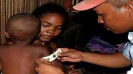 La malnutrición por covid puede causar la muerte de 168.000 niños en el mundo
