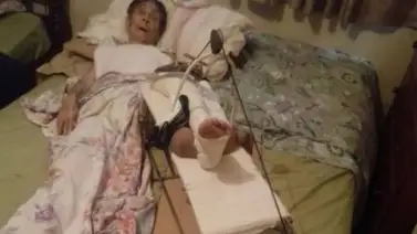 Servicio Público: María necesita ayuda económica para volver a caminar Servicio Público: María necesita ayuda económica para volver a caminar