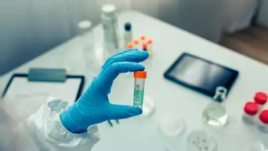 Nuevos casos de COVID-19 se registraron a escala mundial Nuevos casos de COVID-19 se registraron a escala mundial