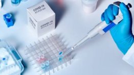 Los contagios en el mundo por la COVID-19 superan los 58,6 millones