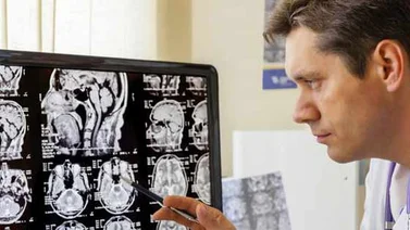 Un neurobiólogo irlandés logra "rejuvenecer" su cerebro