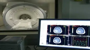 Descubren una nueva alteración en el cerebro de las personas con alzheimer Descubren una nueva alteración en el cerebro de las personas con alzheimer