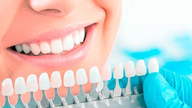 7 maneras de blanquear tus dientes naturalmente