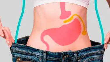 Jennifer Marín: La cirugía bariátrica es una herramienta de salud Jennifer Marín: La cirugía bariátrica es una herramienta de salud