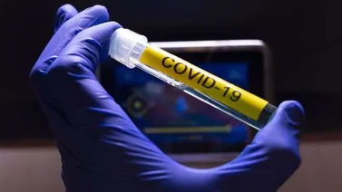 Rusia anuncia para octubre inicio de vacunación masiva contra el Covid-19