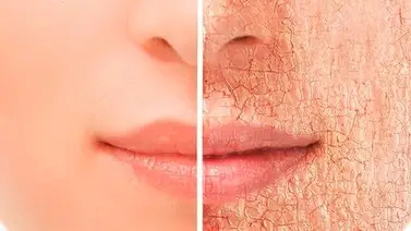 Así se comporta tu piel si no tomas agua Así se comporta tu piel si no tomas agua