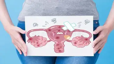 Educar sobre el cuello uterino puede salvar vidas Educar sobre el cuello uterino puede salvar vidas