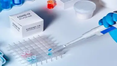 Científicos uruguayos desarrollan y producen test serológicos de Covid-19 Científicos uruguayos desarrollan y producen test serológicos de Covid-19