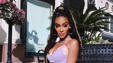 Fotos: Esta modelo con vitiligo derrocha sensualidad en Instagram Fotos: Esta modelo con vitiligo derrocha sensualidad en Instagram