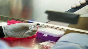Un estudio detecta diferencias en la sangre de pacientes graves y leves de Covid-19