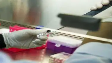Un estudio detecta diferencias en la sangre de pacientes graves y leves de Covid-19 Un estudio detecta diferencias en la sangre de pacientes graves y leves de Covid-19