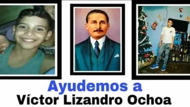 Servicio público: Joven sufrió quemaduras en su cuerpo y necesita ayuda económica