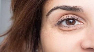 Causas y soluciones de las ojeras