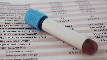 ¿Qué relación hay entre el cáncer y el colesterol? ¿Qué relación hay entre el cáncer y el colesterol?