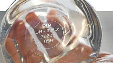 Venezolanas víctimas de prótesis PIP demandarán en Francia