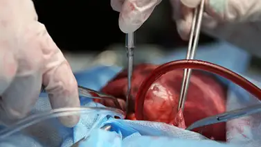 En Venezuela las malformaciones cardiacas afectan alrededor de 6.000 niños al año En Venezuela las malformaciones cardiacas afectan alrededor de 6.000 niños al año