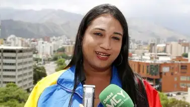 Fallece quemada diputada transgénero del Psuv tras ocho días de agonía Fallece quemada diputada transgénero del Psuv tras ocho días de agonía