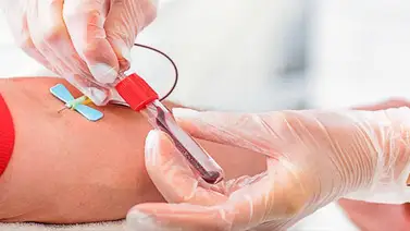 Nueva vacuna reduce el virus latente del VIH y abre nuevas vías de tratamiento Nueva vacuna reduce el virus latente del VIH y abre nuevas vías de tratamiento