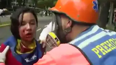 Bomba lacrimógena lanzada por PNB hirió en el rostro a estudiante de la UCV (+Video) Bomba lacrimógena lanzada por PNB hirió en el rostro a estudiante de la UCV (+Video)