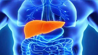 Conoce los cinco tips para prevenir la hepatitis