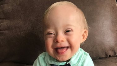 Bebé con síndrome de Down se convierte en la nueva imagen de Gerber