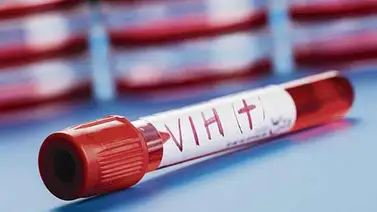 Fondo Mundial evalúa desempeño de Nicaragua contra VIH, malaria y tuberculosis Fondo Mundial evalúa desempeño de Nicaragua contra VIH, malaria y tuberculosis