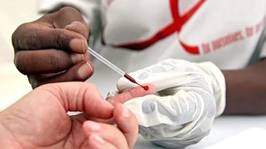 Desarrollan un nuevo método de detección oral del VIH "más sensible"