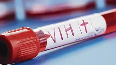 Más de 23.200 personas viven con VIH en Cuba, el 81 % de ellos hombres Más de 23.200 personas viven con VIH en Cuba, el 81 % de ellos hombres