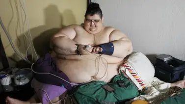 El hombre más obeso del mundo se recupera tras segunda cirugía en México El hombre más obeso del mundo se recupera tras segunda cirugía en México