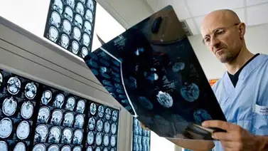 El doctor que promete trasplantar cabezas quiere probar también con cerebros El doctor que promete trasplantar cabezas quiere probar también con cerebros
