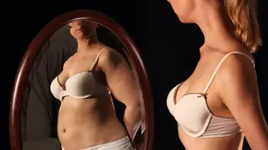 La anorexia deja secuelas físicas y mentales La anorexia deja secuelas físicas y mentales