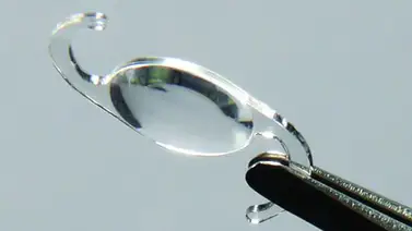 Fabrican en Suiza dos nuevas lentes intraoculares de foco extendida para cirugía de cataratas Fabrican en Suiza dos nuevas lentes intraoculares de foco extendida para cirugía de cataratas