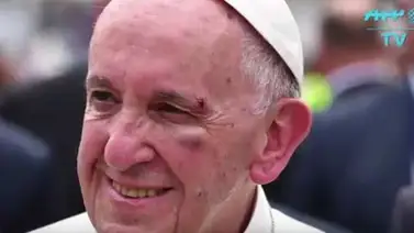 El golpe que sufrió el Papa Francisco en Colombia (+Video) El golpe que sufrió el Papa Francisco en Colombia (+Video)
